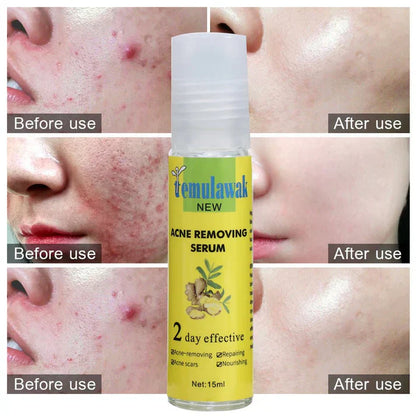 Temulawak - New Acne Removing Serum (Original)